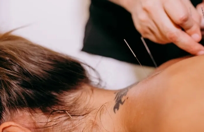 Acupuncture Massage