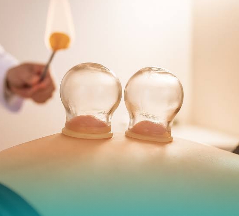 Best Fire Cupping Service in Calgary