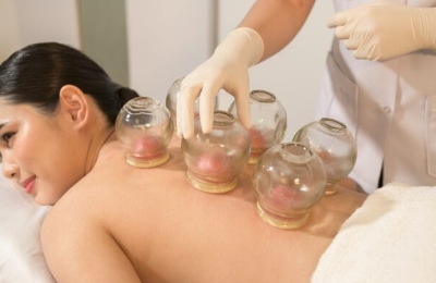 Fire Cupping Service in Calgary